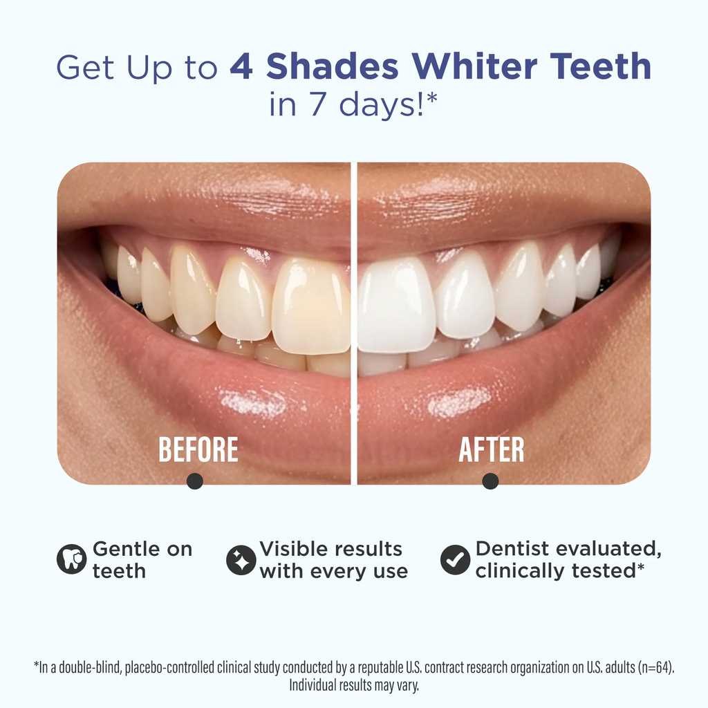 GuruNanda Teeth Whitening Strips – 7-Day Treatment with Coconut Oil | Non-Slip, Vegan & Dentist-Evaluated