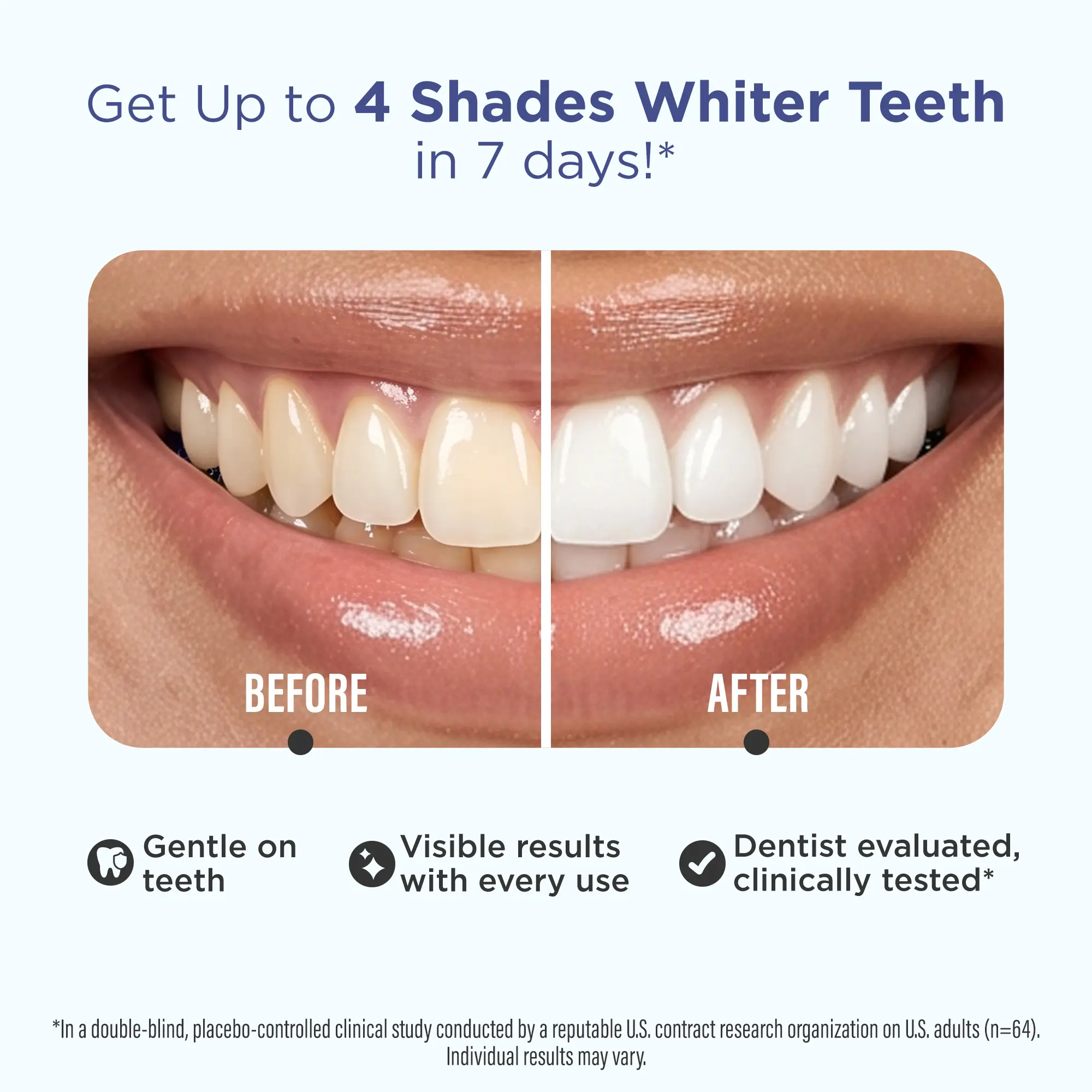GuruNanda Teeth Whitening Strips – 7-Day Treatment with Coconut Oil | Non-Slip, Vegan & Dentist-Evaluated