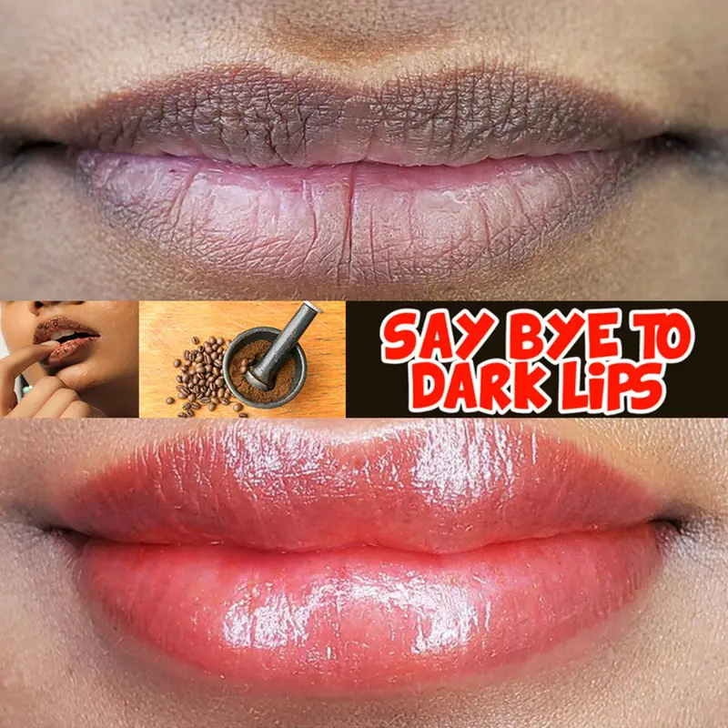 Gentle Lip Treatment Balm – Day & Night Intensive Repair for Dry, Chapped Lips | Even Tone & Radiance Boost