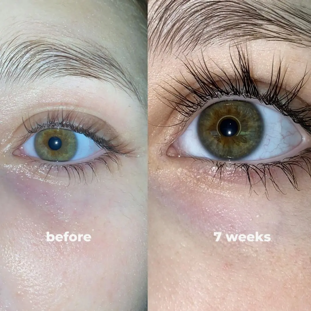 nuorganic Lash & Brow Growth Serum Bundle – Organic Eyelash & Eyebrow Serum for Longer, Thicker Results in 14 Days