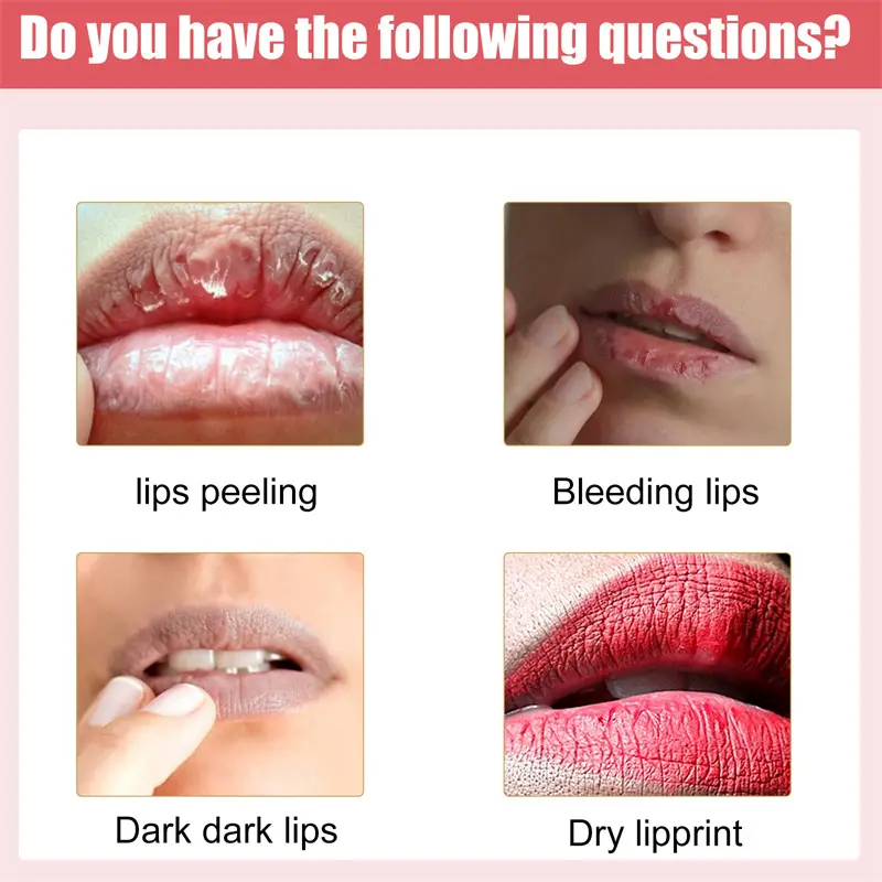 Gentle Lip Treatment Balm – Day & Night Intensive Repair for Dry, Chapped Lips | Even Tone & Radiance Boost