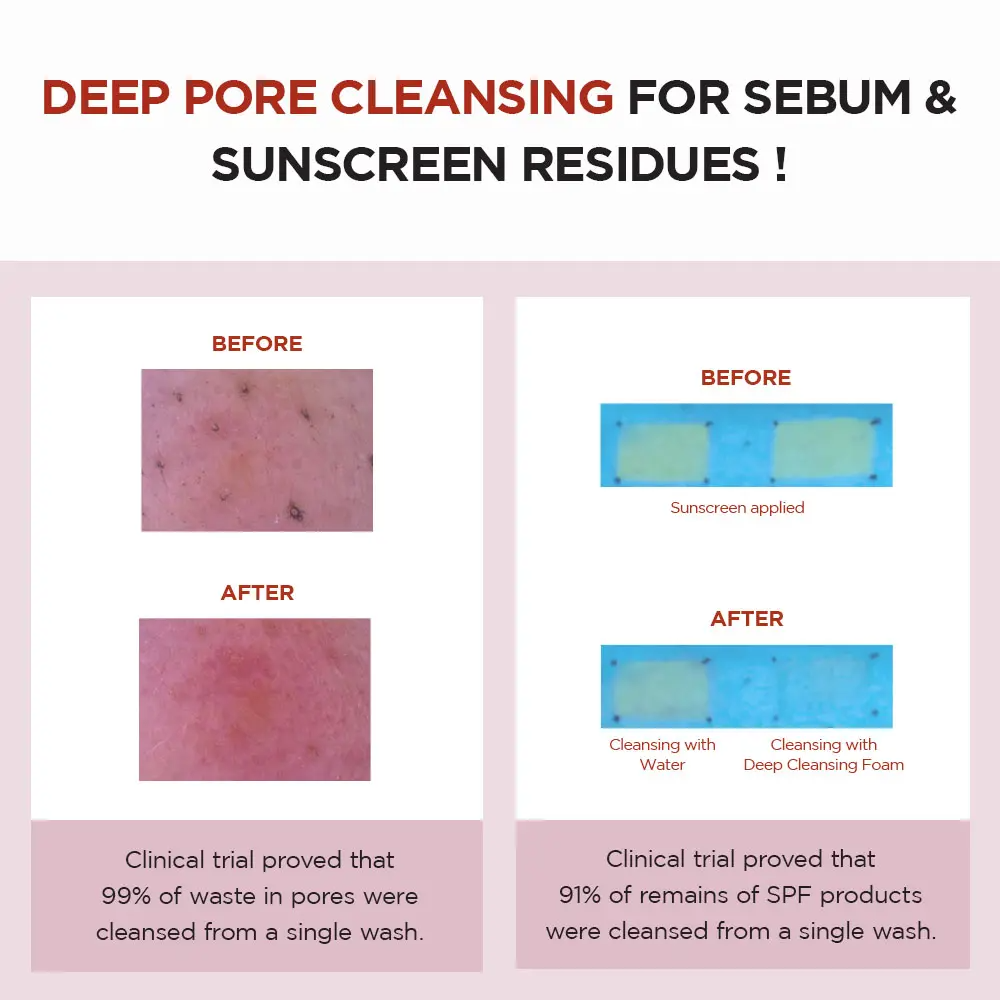 SKIN1004 Madagascar Centella Poremizing Deep Cleansing Foam – Pore Cleansing & Exfoliating with Himalayan Pink Salt | 125ml