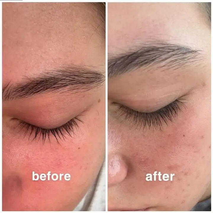 nuorganic Lash & Brow Growth Serum Bundle – Organic Eyelash & Eyebrow Serum for Longer, Thicker Results in 14 Days